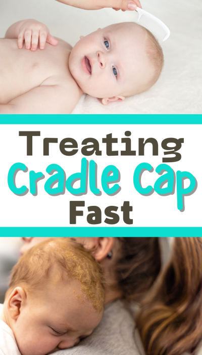 Cradle Cap 2