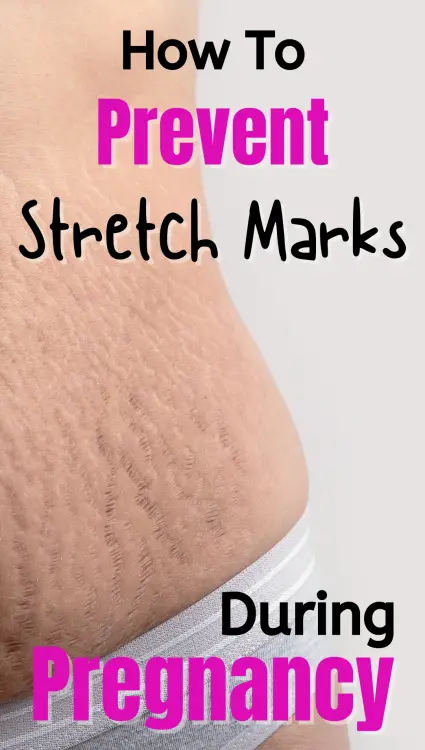 Stretch Mark Prevention 2
